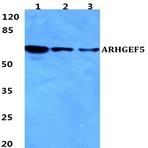 Bs5835_wb