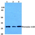 Peroxin-11B pAb