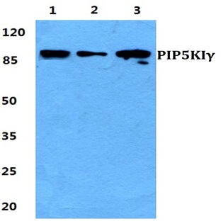 PIP5KI(gamma) pAb