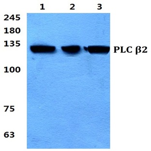 PLC (beta)2 pAb