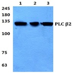 PLC (beta)2 pAb