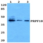 PRPF18 pAb