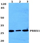 Bs5867_wb