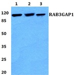 RAB3GAP1 pAb