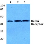 Renin Receptor pAb