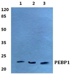 Bs5912_wb