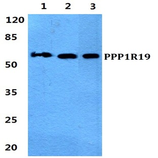 PPP1R19 pAb