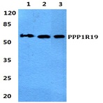 Bs5913_wb