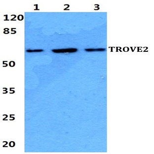 TROVE2 pAb