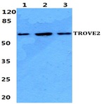 TROVE2 pAb