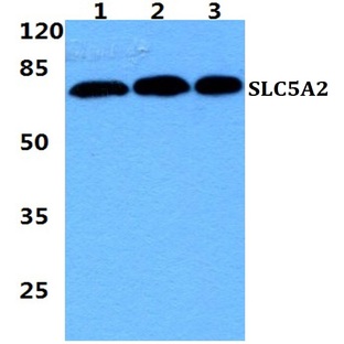 SLC5A2 pAb