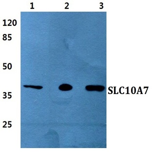 SLC10A7 pAb