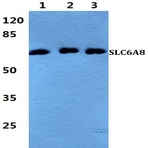 SLC6A8 pAb