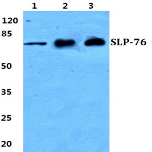 SLP-76 pAb