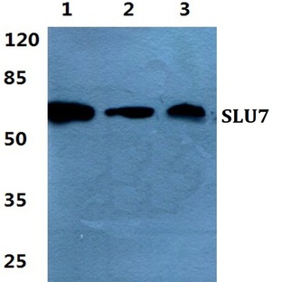 SLU7 pAb