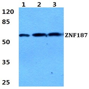 ZNF187 pAb