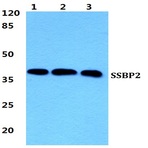 SSBP2 pAb