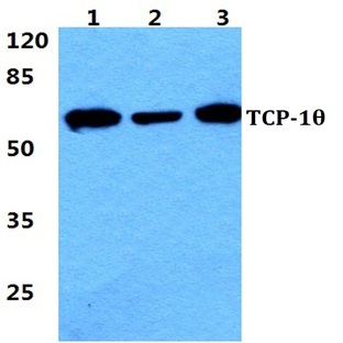 TCP-10 pAb