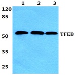 Bs5963_wb