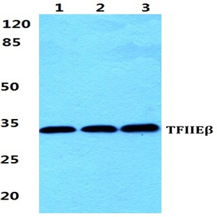 TFIIE-(beta) pAb