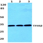 Bs5964_wb