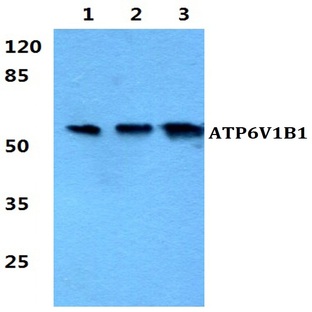 ATP6V1B1 pAb