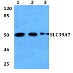 SLC39A7 pAb