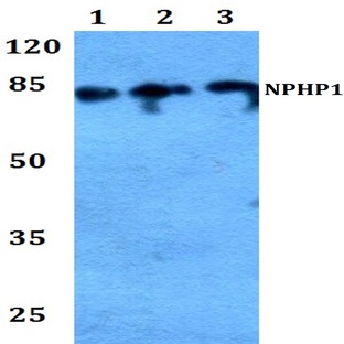 Nephrocystin-1 pAb