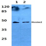 Hexim2 pAb