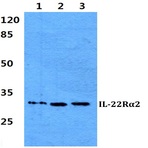 IL-22R(alpha)2 pAb