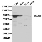 Stat5b pAb