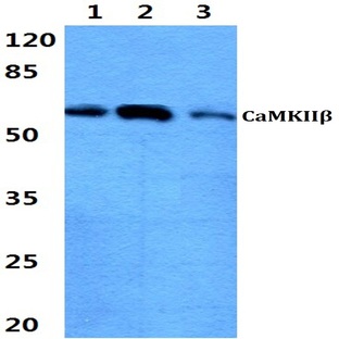 CaMKII(beta) pAb