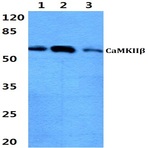 Bs60317_wb