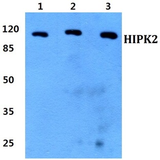 HIPK2 pAb