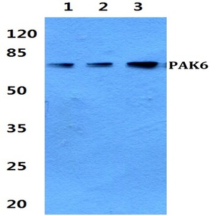 PAK6 pAb 