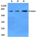 PAK6 pAb 