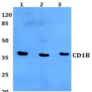 CD1B pAb