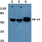 SR-2A pAb