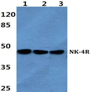 NK-4R pAb