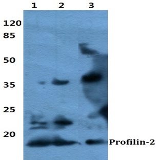 Profilin-2 pAb