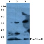 Profilin-2 pAb