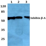 Inhibin (beta)-A pAb