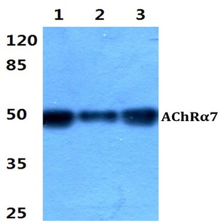 AChR(alpha)7 pAb