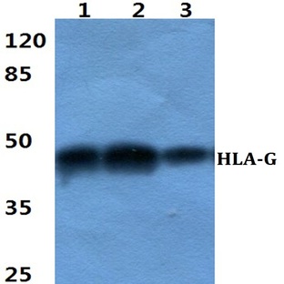 HLA-G pAb