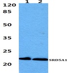 SRD5A1 pAb