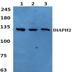 Bs60413_wb