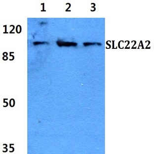 SLC22A2 pAb