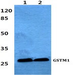 Bs60428_wb