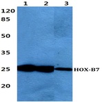 HOX-B7 pAb