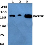 Bs60432_wb